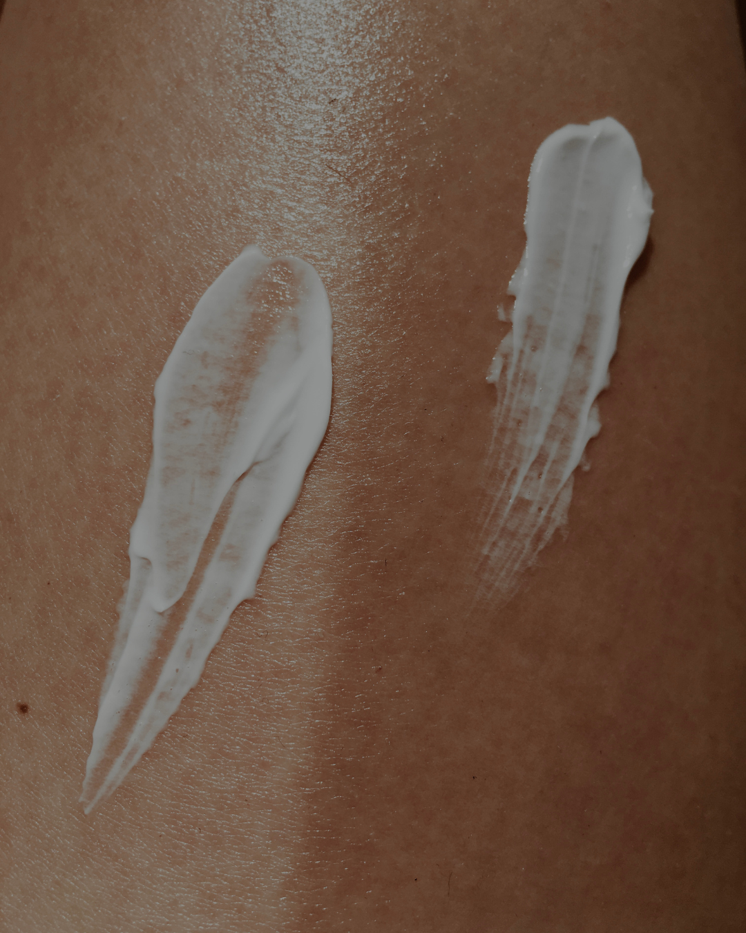 What Is the Skin Barrier?